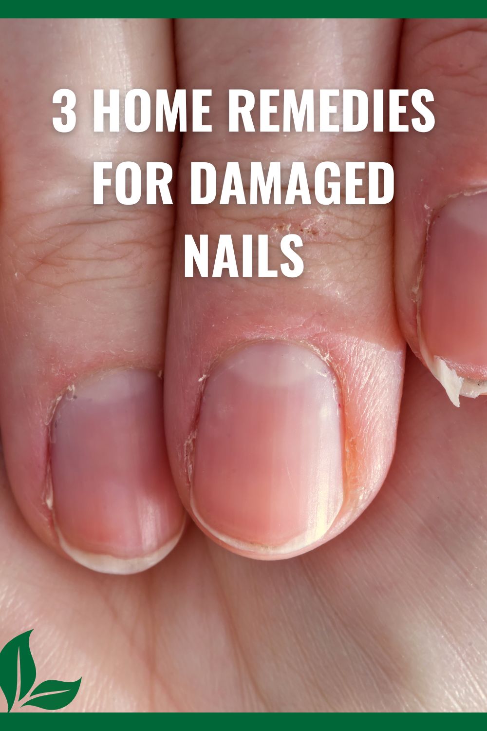 3 home remedies for damaged nails